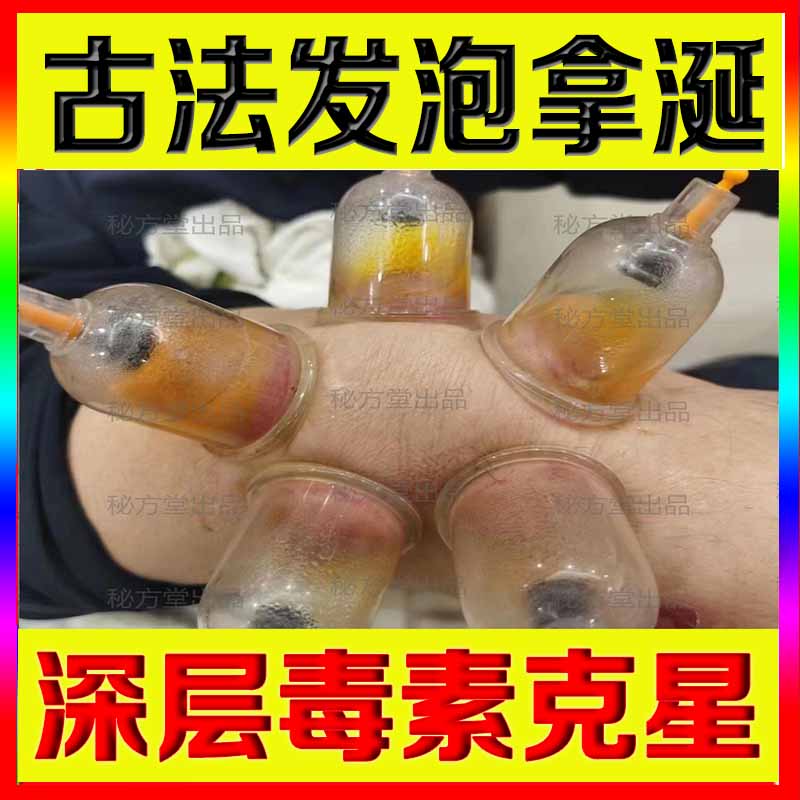 一点灵拔罐排毒液正品正品（2025新品）